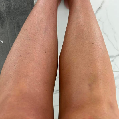 Transform Dry, Aging Skin Into Silky-Smooth Radiance With This Ancient Ayurvedic Ritual (In Just 7 Days)